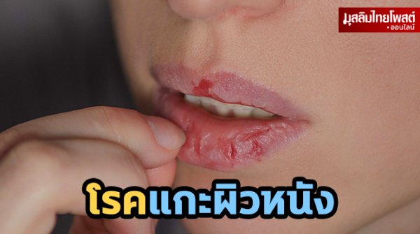 โรคแกะผิวหนัง สัญญาณอันตรายและวิธีรับมืออย่างเหมาะสม